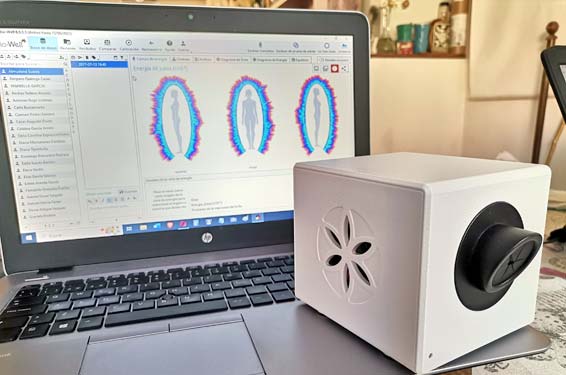 bioelectrografía-biowell